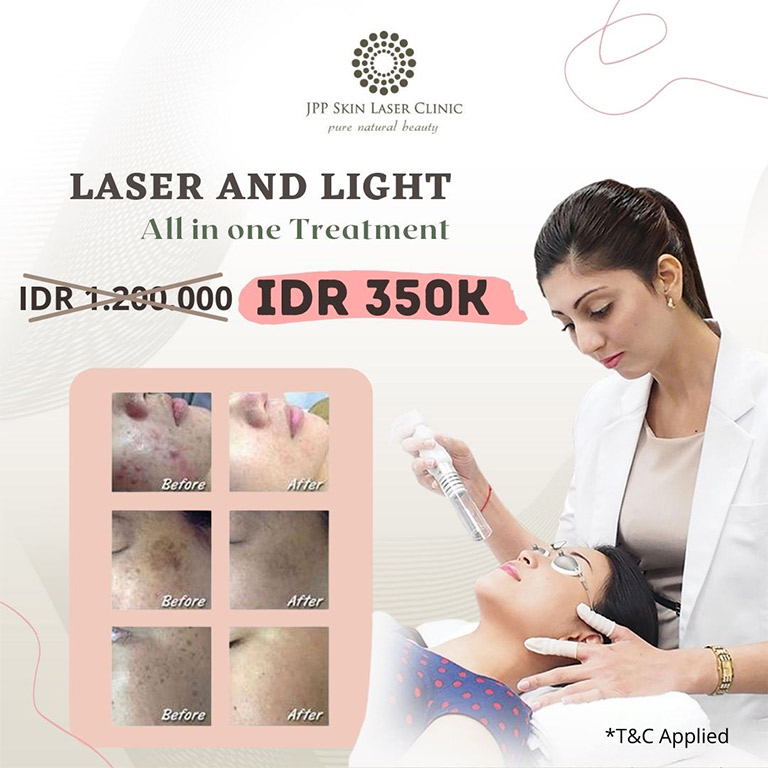 Promo pakaian pria dan wanita, jam tangan pria dan wanita, fashion